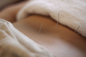 Acupuncture Alleviates Fibromyalgia 